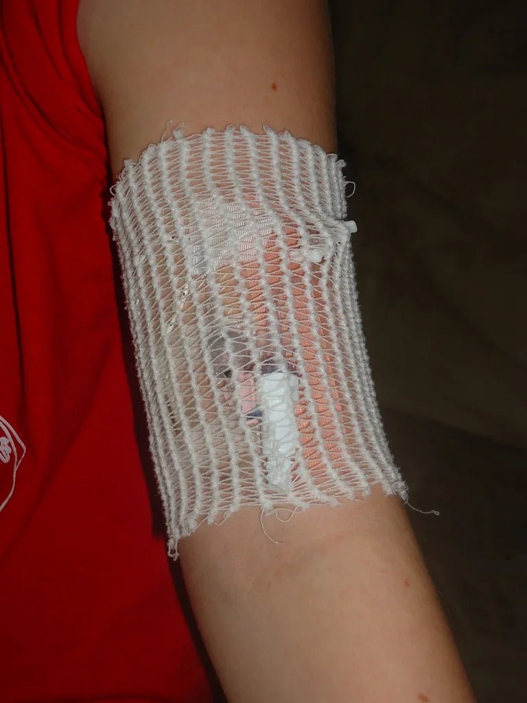 Arm Surgiflex - MedEquip ShopWound Care